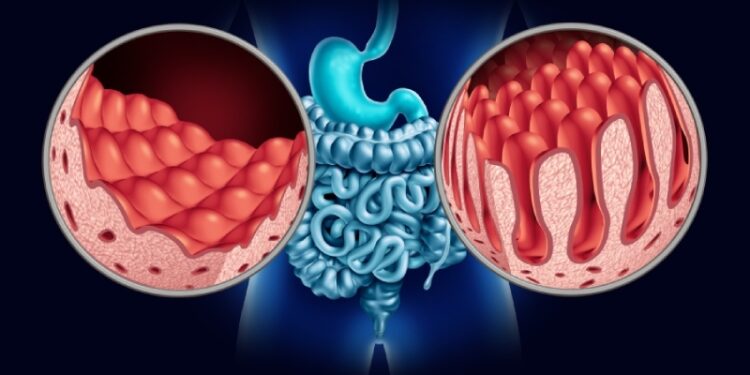 بیماری سلیاک چیست؟ علل، علائم و درمان