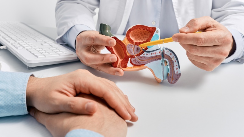 روش های درمان سرطان پروستات